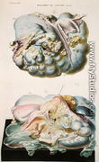 Diseases of the Ovaries, from 'Anatomie Pathologique du Corps Humain' - Antoine Chazal